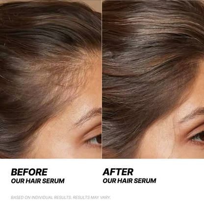 NUNI Hair Growth Serum